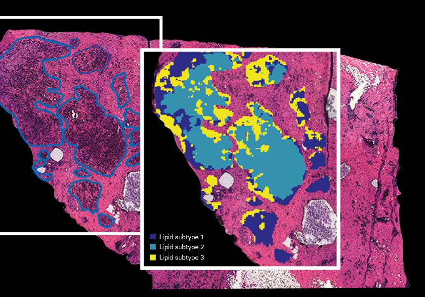 MALDI Imaging, SpatialOMx® i Single Cell. 14 de novembre Bruker_Secció de Proteòmica SCSIE